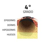 quemaduras de cuarto grado