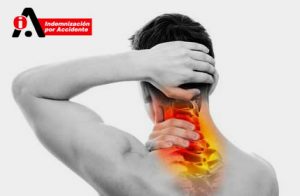 símptomes esquinç cervical