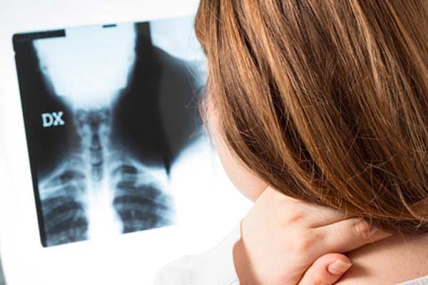 cervicalgia postraumatica